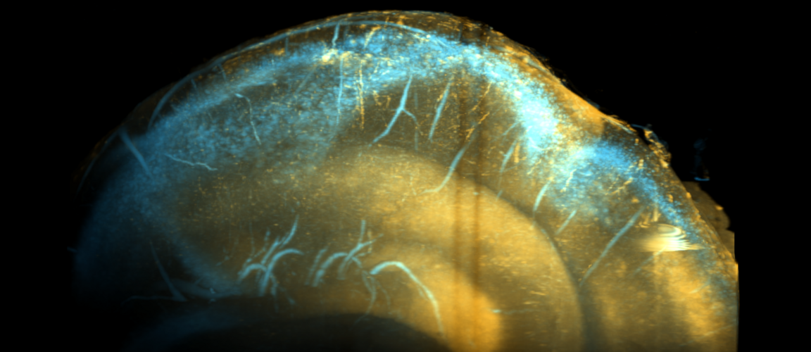 Cleared brain, cleared and imaged by Haijiang Zhang (CUBIC), sample by Syam Nair